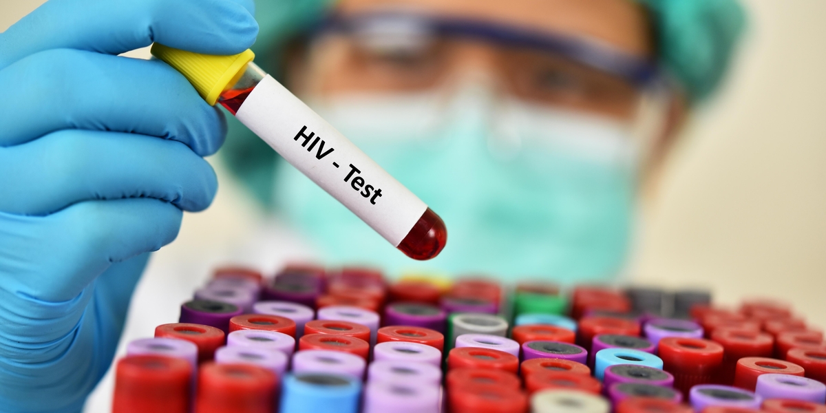 hiv virus medical concept human immunodeficiency 2023 04 03 21 45 12 utc
