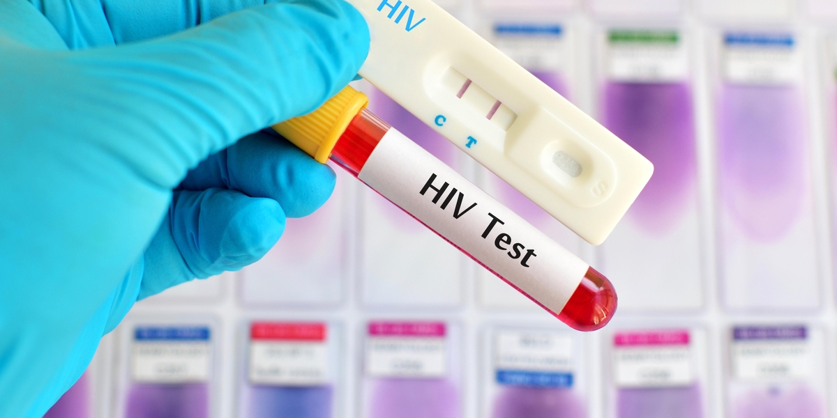 hiv virus medical concept human immunodeficiency 2023 04 03 21 45 13 utc