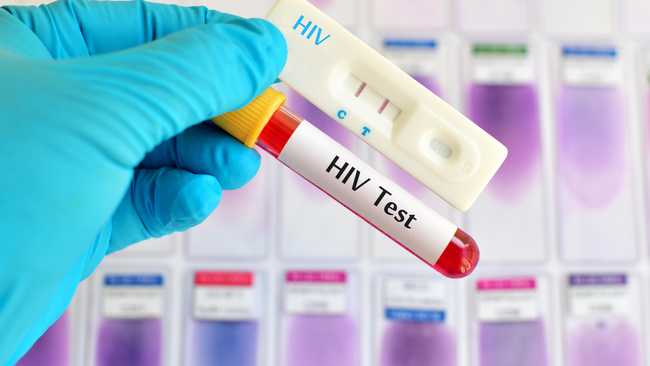 hiv virus medical concept human immunodeficiency 2023 04 03 21 45 13 utc